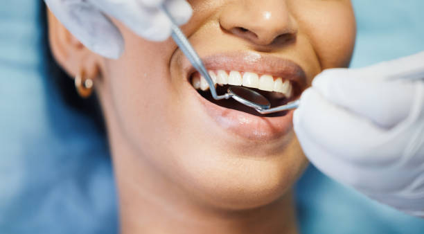 Best Emergency Dental Surgery in San Francisco, CA