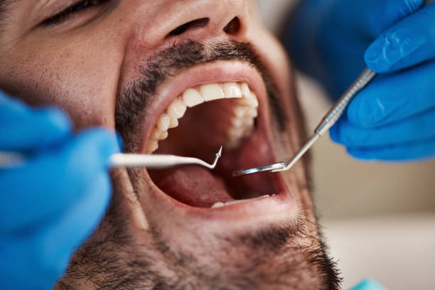 Best Emergency Dental Care for Trauma or Injury in San Francisco, CA