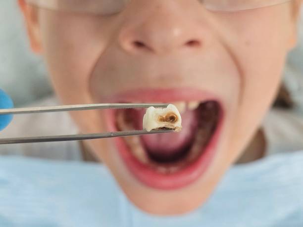 Best Pediatric Emergency Dentist in San Francisco, CA
