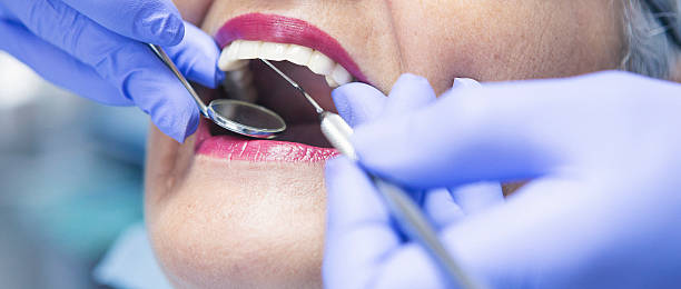 Best Emergency Dental Surgery in San Francisco, CA